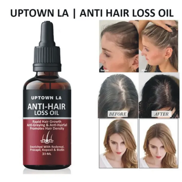 Uptown LA Anti Hair Loss Oil
